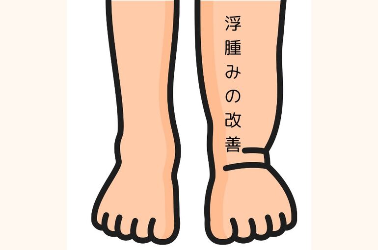 浮腫みの改善