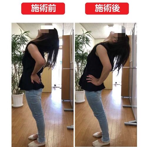 腰痛の痛みが即日改善！
