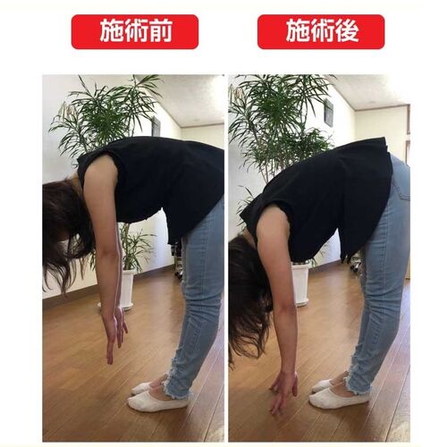歩けない腰痛にも対応！