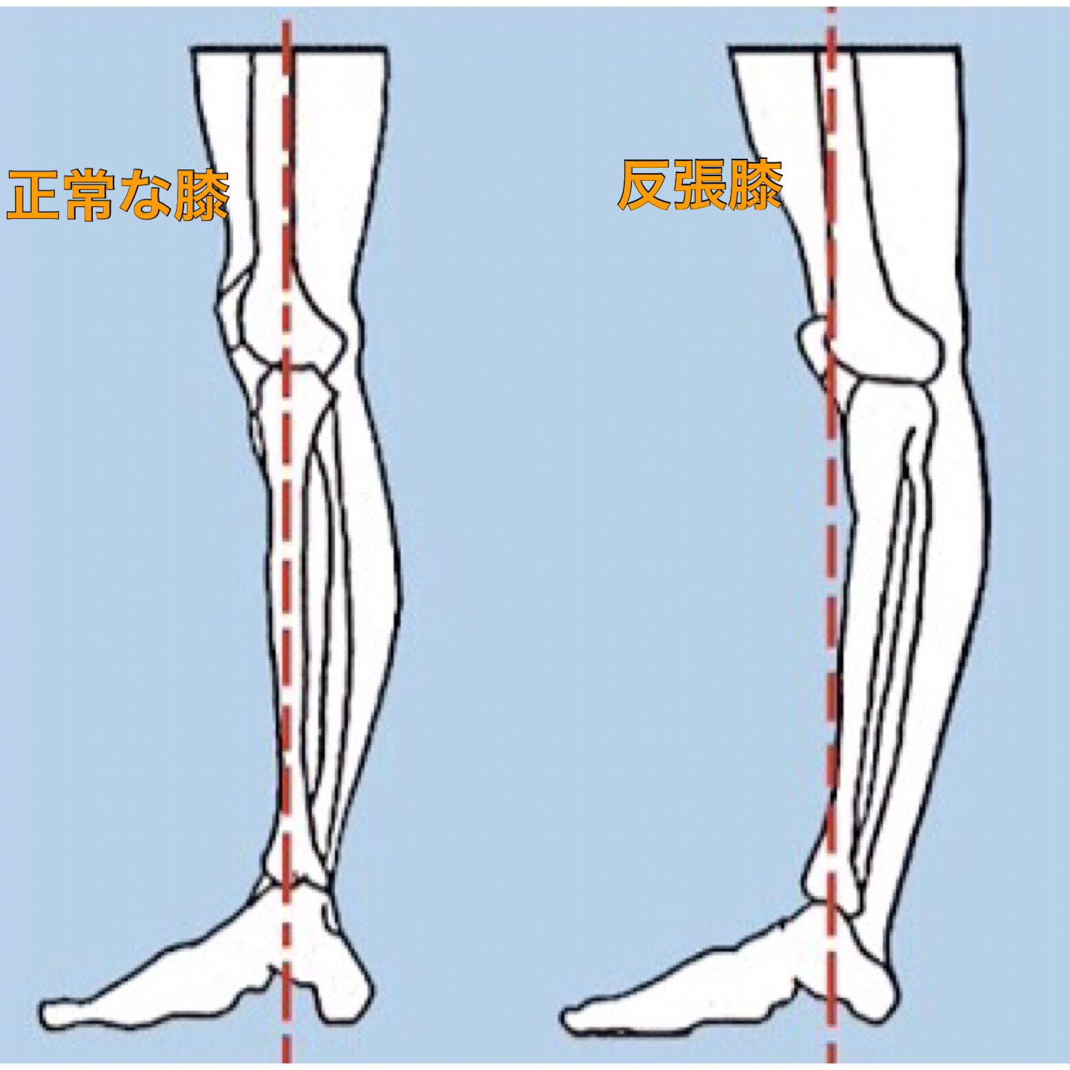 é</div>
            
			
			
			<div class=